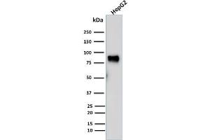 Western Blotting (WB) image for anti-Mdm2, p53 E3 Ubiquitin Protein Ligase Homolog (Mouse) (MDM2) (AA 154-167) antibody (ABIN6940030)