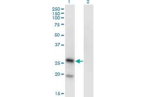 Western Blot analysis of KLRA1 expression in transfected 293T cell line by KLRA1 monoclonal antibody (M01), clone 1H3. (KLRA1 Antikörper  (AA 66-171))