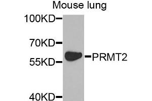 Western blot analysis of extracts of mouse lung cells, using PRMT2 antibody. (PRMT2 Antikörper)