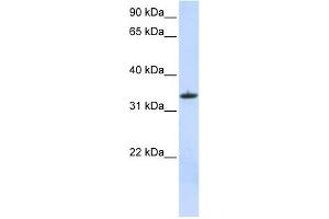 WB Suggested Anti-MRPL15 Antibody Titration:  0.