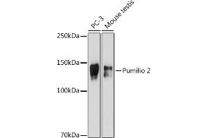 Western blot analysis of extracts of various cell lines, using Pumilio 2 antibody (ABIN7269747) at 1:500 dilution. (PUM2 Antikörper)