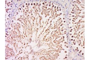 Paraformaldehyde-fixed, paraffin embedded rat testis, Antigen retrieval by boiling in sodium citrate buffer (pH6) for 15min, Block endogenous peroxidase by 3% hydrogen peroxide for 30 minutes, Blocking buffer (normal goat serum) at 37°C for 20min, Antibody incubation with Rabbit Anti-AMN1 Polyclonal Antibody, Unconjugated  at 1:500 overnight at 4°C, followed by a conjugated secondary for 90 minutes and DAB staining. (AMN1 Antikörper  (AA 1-100))