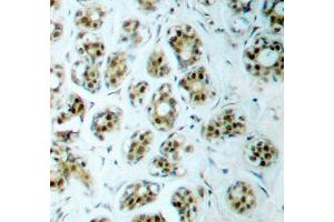 Immunohistochemistry (IHC) image for anti-Nuclear Factor-kB p65 (NFkBP65) (pSer311) antibody (ABIN1870583) (NF-kB p65 Antikörper  (pSer311))