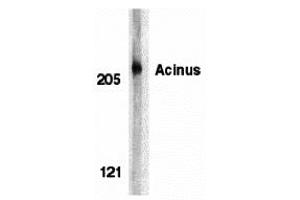 Western blot analysis of acinus in K562 whole cell lysate with acinus antibody at 1 µg/mL. (ACIN1 Antikörper  (N-Term))