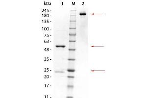 SDS-PAGE of Mouse anti-GSTK1 Monoclonal Antibody.