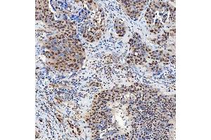 IHC analysis of SNF2H/SMARCA5 using anti-SNF2H/SMARCA5 antibody (ABIN7602001).
