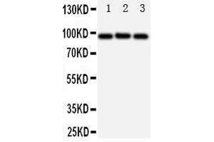 Western Blotting (WB) image for anti-ATP-Binding Cassette, Sub-Family B (MDR/TAP), Member 6 (ABCB6) (AA 818-842), (C-Term) antibody (ABIN3044283) (ABCB6 Antikörper  (C-Term))