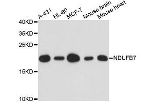 Western blot analysis of extracts of various cell lines, using NDUFB7 antibody. (NDUFB7 Antikörper  (AA 1-137))