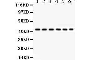 Western Blotting (WB) image for anti-KIN, Antigenic Determinant of RecA Protein Homolog (KIN) (AA 3-202) antibody (ABIN3042474) (KIN Antikörper  (AA 3-202))