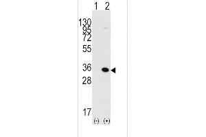 Western blot analysis of MBD3 (arrow) using rabbit polyclonal MBD3 Antibody (C-term) (ABIN387891 and ABIN2844115). (MBD3 Antikörper  (C-Term))