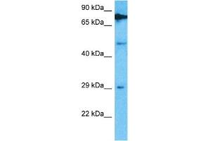 Host:  Rabbit  Target Name:  TRMT61B  Sample Type:  Hela Whole Cell lysates  Antibody Dilution:  1. (TRMT61B Antikörper  (C-Term))