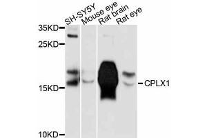 Western blot analysis of extracts of various cell lines, using CPLX1 antibody (ABIN5997502) at 1:3000 dilution. (Complexin 1 Antikörper)