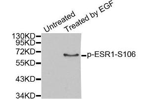 Western blot analysis of extracts from MCF7 cells, using Phospho-ESR1-S106 antibody. (Estrogen Receptor alpha Antikörper  (pSer106))