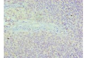 Immunohistochemistry (IHC) image for anti-Achalasia, Adrenocortical Insufficiency, Alacrimia (AAAS) (AA 287-546) antibody (ABIN7143615)