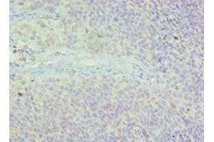 Immunohistochemistry of paraffin-embedded human tonsil tissue using ABIN7143615 at dilution of 1:100