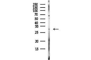 anti-Peptidase Inhibitor 15 (PI15) antibody
