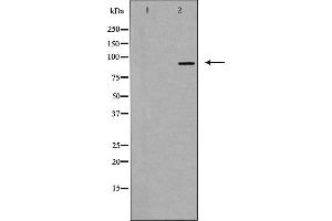 Western blot analysis of extracts from HUVEC cells, using RBM5 antibody. (RBM5 Antikörper  (N-Term))