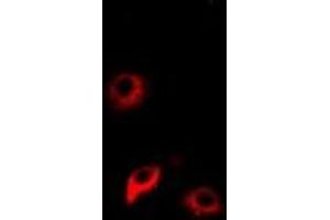 Immunofluorescent analysis of NNMT staining in Hela cells. (NNMT Antikörper)