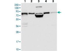 Western blot analysis of Lane 1: RT-4, Lane 2: U-251 MG, Lane 3: Human Plasma, Lane 4: Liver, Lane 5: Tonsil with PEX5 polyclonal antibody  at 1:250-1:500 dilution. (PEX5 Antikörper)