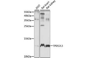 Western blot analysis of extracts of various cell lines, using TPD52L3 antibody. (TPD52L3 Antikörper)