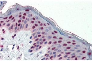 Immunohistochemistry with Human Skin lysate tissue at an antibody concentration of 5. (FOSL1 Antikörper  (Middle Region))