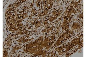ABIN6275528 at 1/100 staining Human kidney tissue by IHC-P. (STK32C Antikörper  (Internal Region))