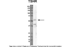 Sample Type: Nthy-ori cell lysate (50ug)Primary Dilution: 1:1000Secondary Antibody: anti-rabbit HRPSecondary Dilution: 1:2000Image Submitted By: Anonymous (TSH receptor Antikörper  (N-Term))