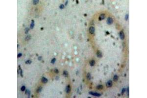 Used in DAB staining on fromalin fixed paraffin-embedded Kidney tissue (PPIA Antikörper  (AA 2-164))