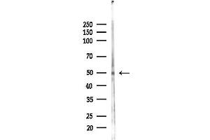 anti-5'-Nucleotidase Domain Containing 4 (NT5DC4) antibody