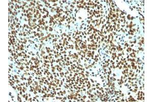 Image no. 3 for anti-Nuclear Antigen antibody (ABIN6190865) (Nuclear Antigen Antikörper)