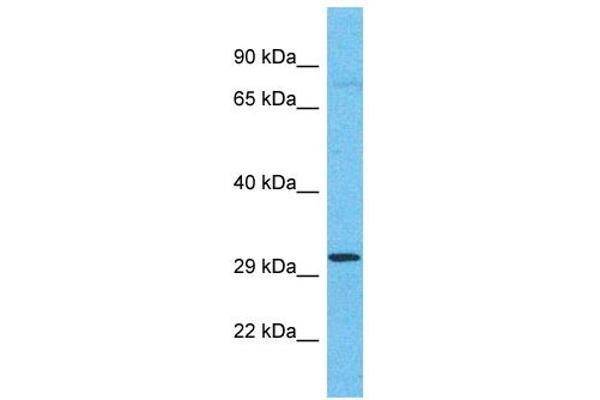 OR4C11 Antikörper  (C-Term)