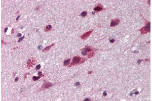 Human Brain Cortex (formalin-fixed, paraffin-embedded) stained with TNIP2 antibody ABIN290395 at 5 ug/ml followed by biotinylated goat anti-rabbit IgG secondary antibody ABIN481713, alkaline phosphatase-streptavidin and chromogen. (TNIP2 Antikörper)