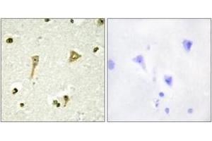 Immunohistochemistry analysis of paraffin-embedded human brain tissue, using TSC22D1 Antibody. (TSC22D1 Antikörper  (AA 71-120))