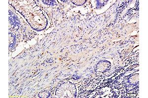 L1 rat lung lysates L2 human colon carcinoma lysates probed with Anti TIMP-1 Polyclonal Antibody, Unconjugatedat 1:200 overnight at 4 °C. (TIMP1 Antikörper  (AA 131-207))
