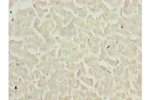 Immunohistochemistry of paraffin-embedded human heart tissue using ABIN7159481 at dilution of 1:100 (TIMP1 Antikörper  (AA 24-207))