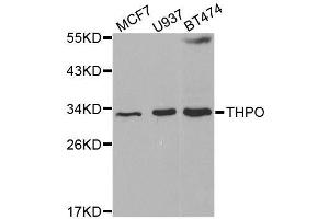 Western blot analysis of extracts of various cell lines, using THPO antibody. (Thrombopoietin Antikörper  (AA 22-349))