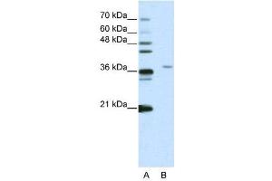 Western Blotting (WB) image for anti-Squamous Cell Carcinoma Antigen Recognized By T Cells 3 (SART3) (N-Term) antibody (ABIN2780944)