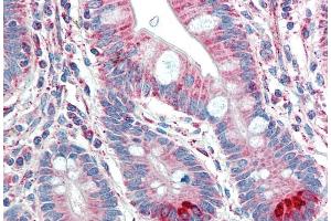 ABIN184703 (5µg/ml) staining of paraffin embedded Human Small Intestine. (TMPRSS5 Antikörper  (C-Term))