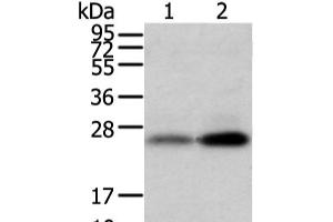 Western blot analysis of Mouse trachea and brain tissue using WFDC5 Polyclonal Antibody at dilution of 1:1100 (WFDC5 Antikörper)