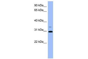PSPH antibody used at 1 ug/ml to detect target protein. (PSPH Antikörper  (Middle Region))