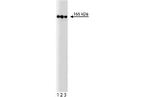 Western Blotting (WB) image for anti-Phosphatidylinositol-4-Phosphate 3-Kinase, Catalytic Subunit Type 2 beta (PIK3C2B) (AA 16-209) antibody (ABIN968482)
