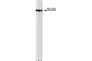 Western blot analysis of PI3-Kinase C2beta on a HeLa lysate. (PIK3C2B Antikörper  (AA 16-209))