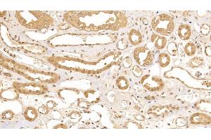 Detection of CRYl1 in Human Kidney Tissue using Polyclonal Antibody to Crystallin Lambda 1 (CRYl1)