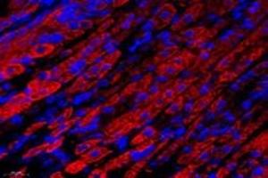 Immunofluorescent analysis of paraformaldehyde-fixed mouse stomach using,NCKAP1 (ABIN7074784) at dilution of 1: 1000 (NCKAP1 Antikörper)