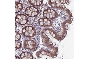 Immunohistochemical staining of human colon with FAM125A polyclonal antibody  shows moderate cytoplasmic and membranous positivity in glandular cells at 1:50-1:200 dilution.