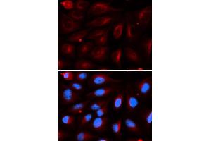 Immunofluorescence (IF) image for anti-Protein Inhibitor of Activated STAT, 2 (PIAS2) antibody (ABIN1876855) (PIAS2 Antikörper)