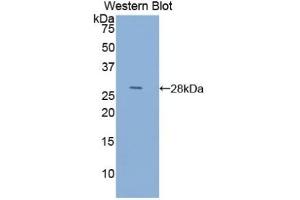 Detection of Recombinant ACTC1, Human using Anti-Actin Alpha 1, Cardiac Muscle (ACTC1) Polyclonal Antibody (ACTC1 Antikörper  (AA 156-368))