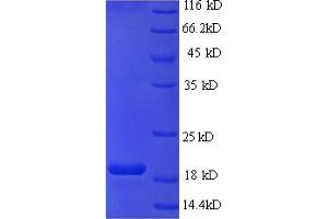 SDS-PAGE (SDS) image for VE6 (AA 1-158), (full length) protein (His tag) (ABIN5711129) (VE6 (AA 1-158), (full length) protein (His tag))