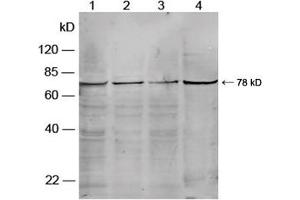 Western blot analysis of cell lysates using Rabbit Anti-PKG-2 Polyclonal Antibody (ABIN398685) Lane 1. (PKG-2 Antikörper)