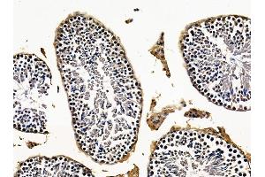 ABIN7096261 and ABIN7100323 at 1/100 staining mouse testis tissue by IHC-P. (SLC25A43 Antikörper)